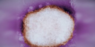 Monkeypox
