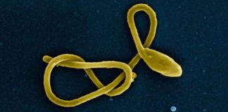 Ebola