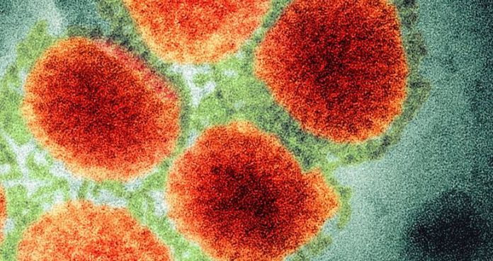 H3N2