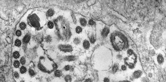 Marburg virus