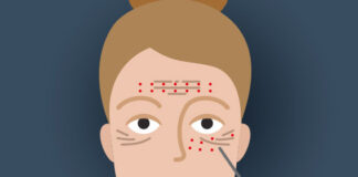 vampire facial