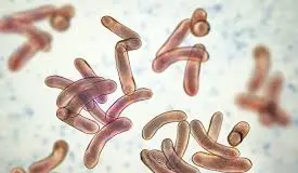 cholera