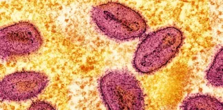 Mpox